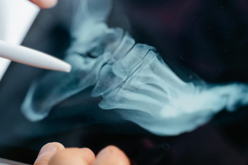 Osteopur Explained: The Science Behind Bone Health Support in 2026